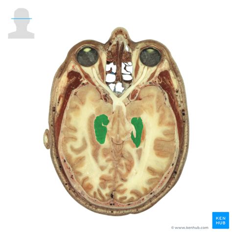 Dentate Gyrus - Anatomy | Kenhub