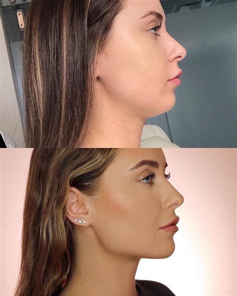 Skin by Lovely™ on Instagram: “repost from @kristinaxmakeup : Side ...