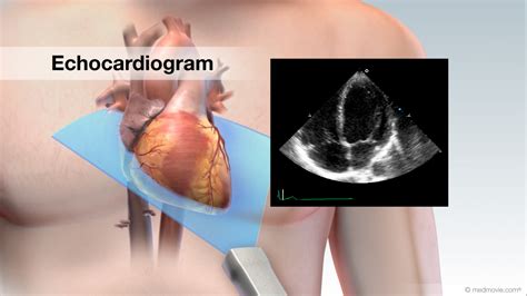 3d Ultrasound Of The Heart