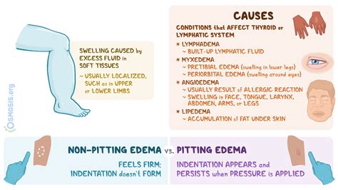 Non-pitting Edema: What Is It, Causes, Diagnosis | Osmosis