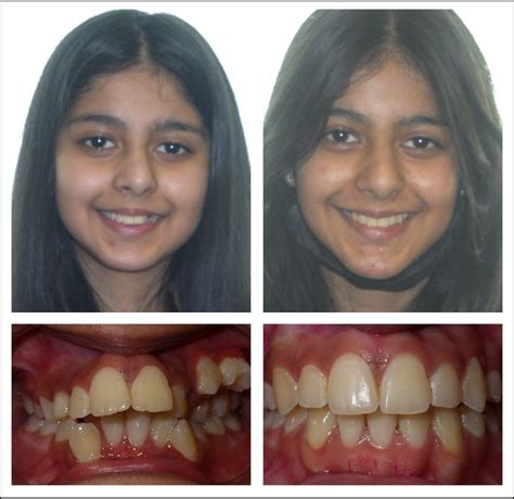 Philadelphia Orthodontist - Cosmetic Dentistry in Philadelphia ...