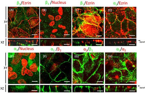 Domain-specific distribution of the Na+, K+-ATPase isoforms in ARPE-19 ...