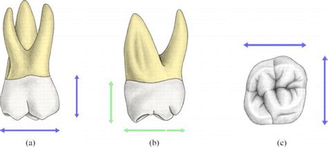 Maxillary 2nd Molar Root Canal Anatomy