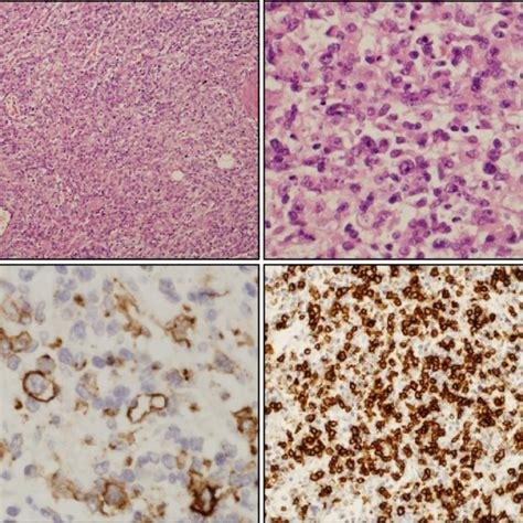 The figure represents morphology and immunophenotype of the ...