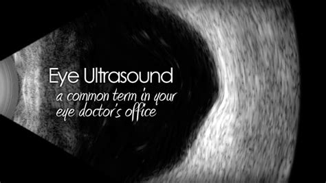 Eye ultrasound - a patient's guide