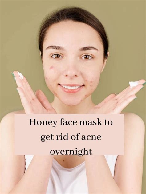 Honey face mask to get rid of acne overnight - Biggrow