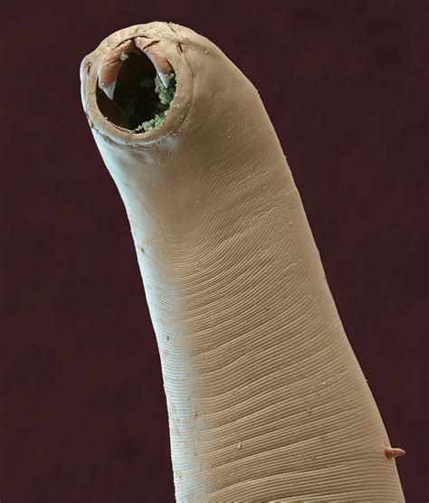 hookworm in humans - pictures, photos