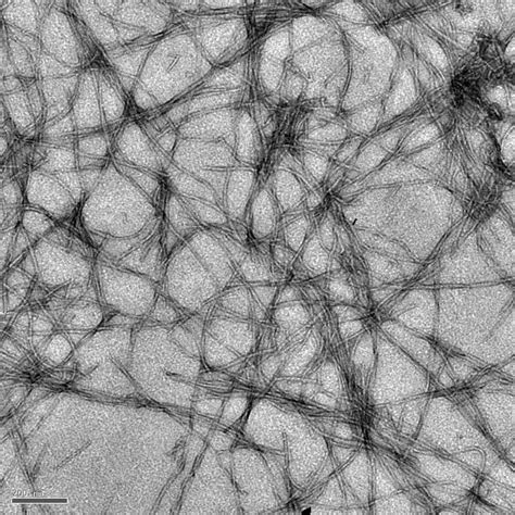 Molecules 'light up' Alzheimer's roots: Light-switching complex ...