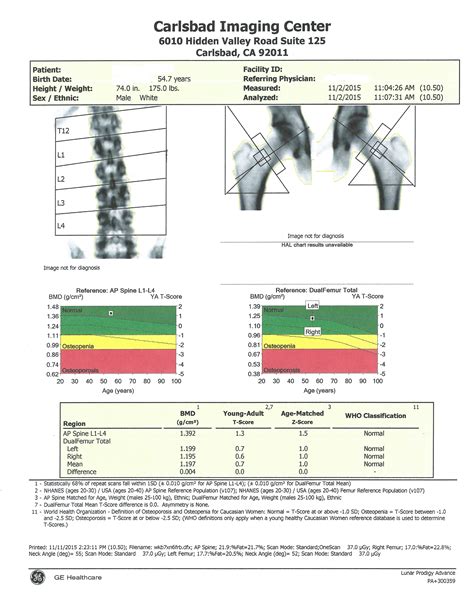 Dexa Bone Density Scan