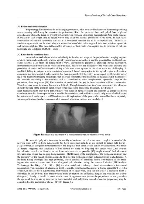 Taurodontism; clinical considerations