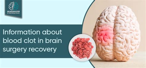 what you can expect from your brain blood clot surgery recovery