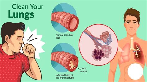 What Does The Back Of Your Throat Look Like