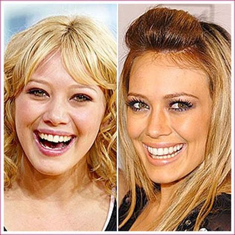 Scary Celebrity Plastic Surgery Before And After | Hilary Duff, Young ...