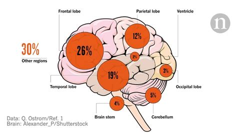 33 Top Images Brain Stem Tumor In Cats : Your Marvellous Brain. Part 1 ...