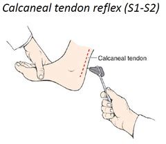 Foot Evaluation - Morphopedics