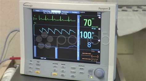 Ecg Monitor Hospital