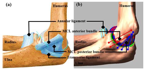 Bioengineering | Free Full-Text | Medial Collateral Ligament Deficiency ...