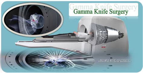 Gammaknife surgery India | Dr. Dheeraj Bojwani