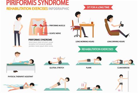 Rehab Piriformis Syndrome