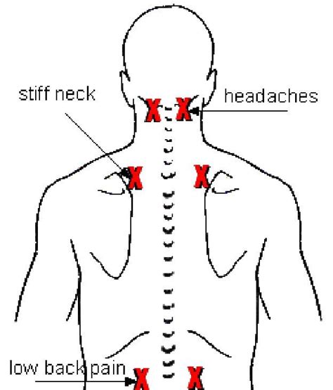 Embedded image Pressure Point Therapy, Trigger Point Therapy, Blood ...