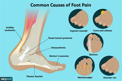 Foot Ankle Surgery and Some Causes – Dr. Babajide A. Ogunlana, DPM ...