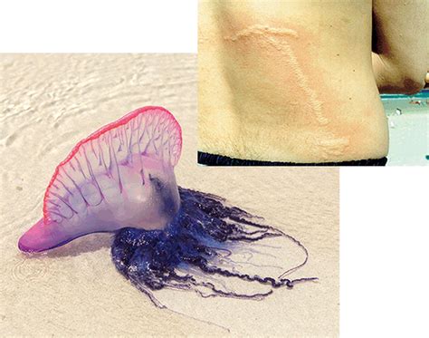 Stinging jellyfish clue