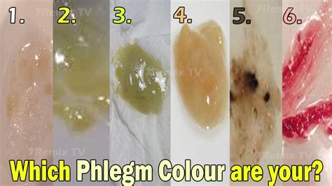 What does my phlegm color mean – The Meaning Of Color