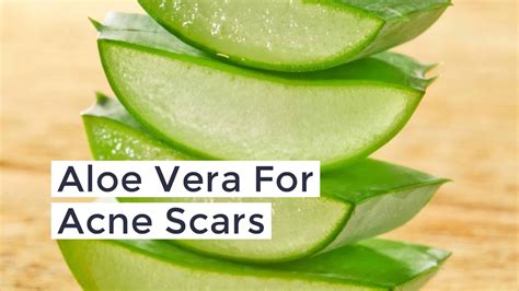 How to Clear Acne Scars using Aloe Vera