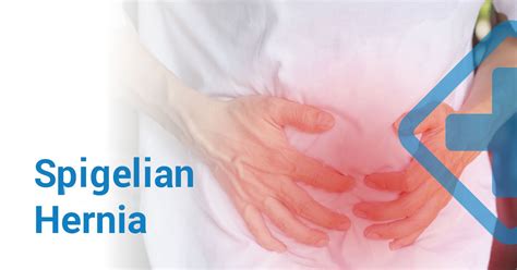 Spigelian Hernia: Symptoms, Diagnosis & Recovery