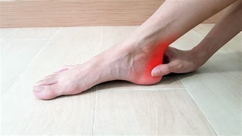 7 Ways to Treat Heel Bone Spurs - Foot and Ankle Group