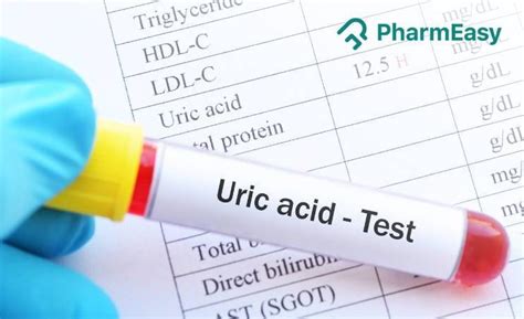 High Uric Acid Level: Causes, Risks, Treatment, Prevention - PharmEasy Blog