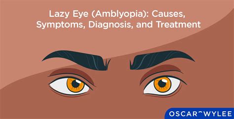 Lazy Eye (Amblyopia): Causes, Symptoms, Diagnosis, and Treatment