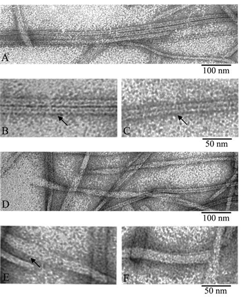 New morphology of amyloid fibrils – Atlas of Science