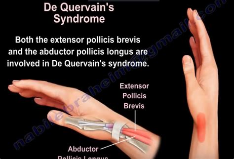 Anatomy of #Extensor Pollicis Brevis — OrthopaedicPrinciples.com