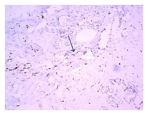 Immunohistochemistry with DAB staining. (a) The arrow head presents the ...