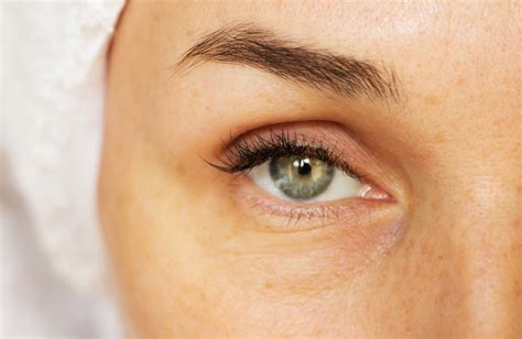 Die magischen und faltenlöschenden Vorteile von Under Eye Fillers-My ...