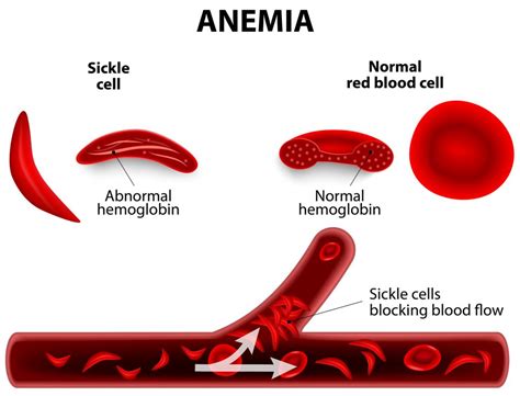 Red Blood Cells Function - Causes of Elevated, High, Large