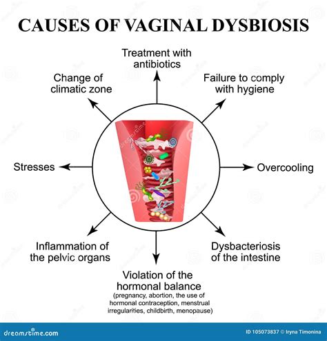 Treatment Of Vaginitis Suppositories. Inflammation The Vagina ...