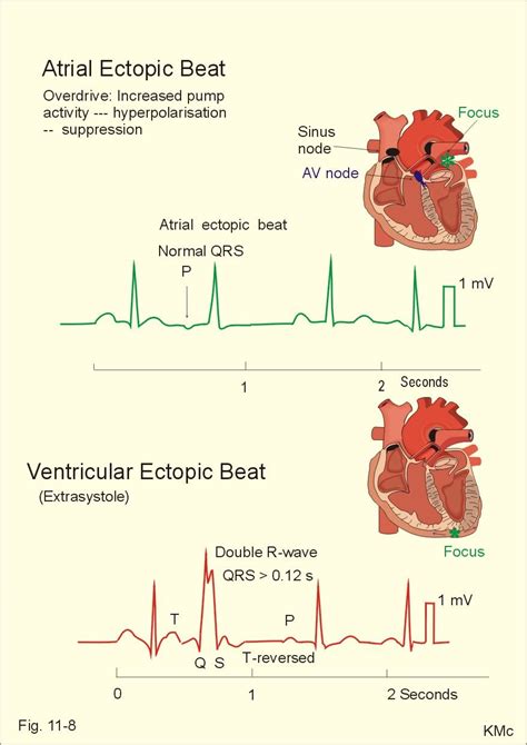 New Human Physiology Ch 11 | Physiology, Medical knowledge, Medical ...