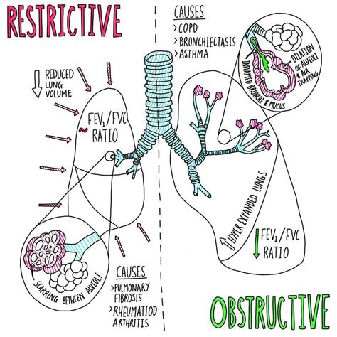 Restrictive vs Obstructive Lung Disease 🌬 #medicalstudent #medstudent # ...