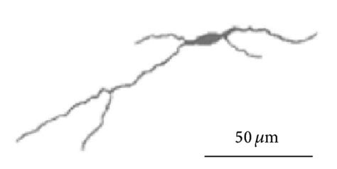 Representative examples of large neurons of the human dentate nucleus ...