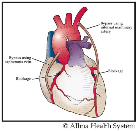 Cad medical abbreviation - powenplanning