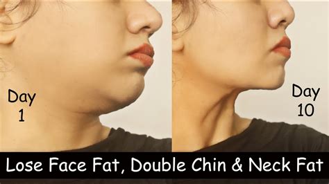 Lose Double Chin & Face Fat in 10 Days - Lose Neck Fat | Slim Face ...