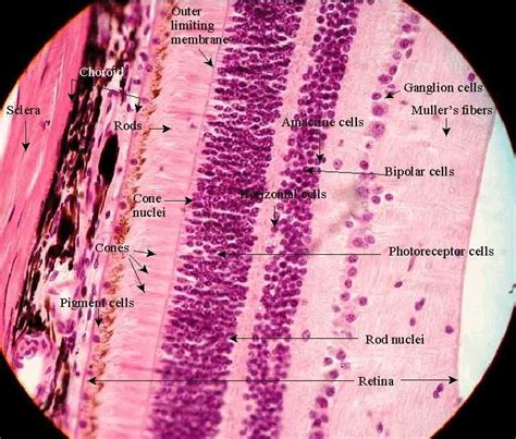 loose body histology