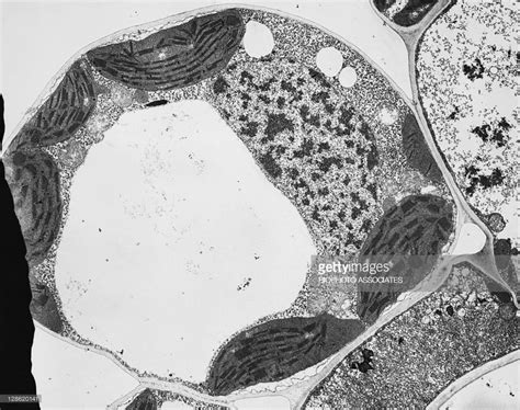 Palisade Mesophyll Cell of the Leaf Diagram | Quizlet