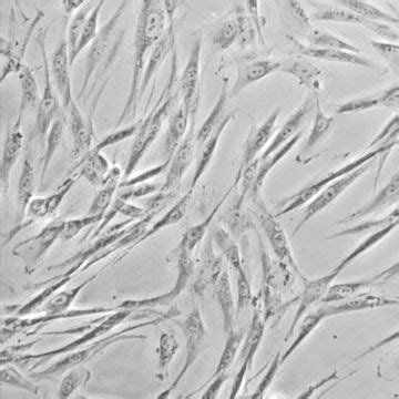 Human Dental Pulp Stem Cells | Axol Bioscience