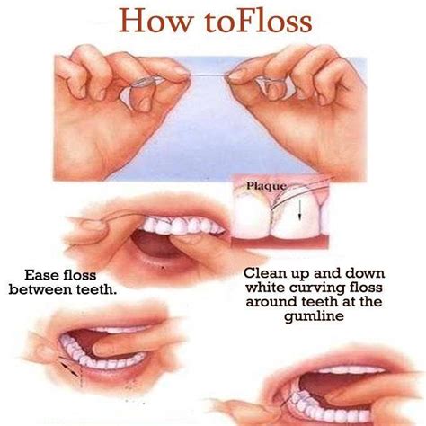 Dental Flossing Technique