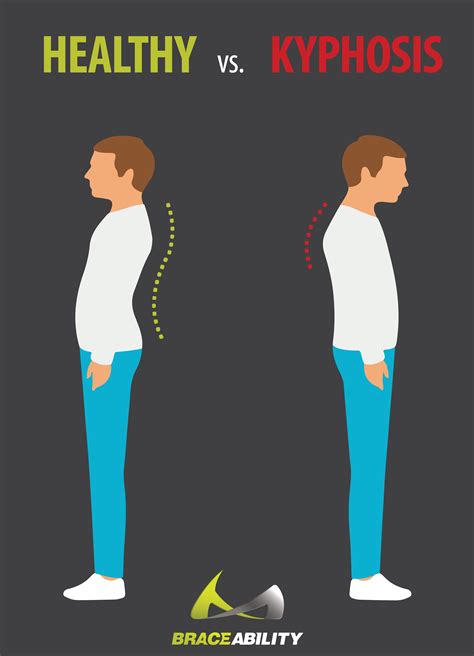 Kyphosis Back Braces | Kyphosis Treatment, Postural Kyphosis Brace