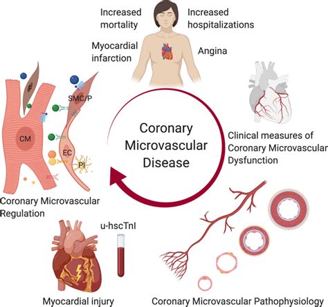 Establishing the Link Between Coronary Microvascular Disease and ...