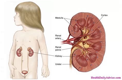 Wilms Tumor - Causes, Symptoms, Diagnosis, Treatment & Pathology